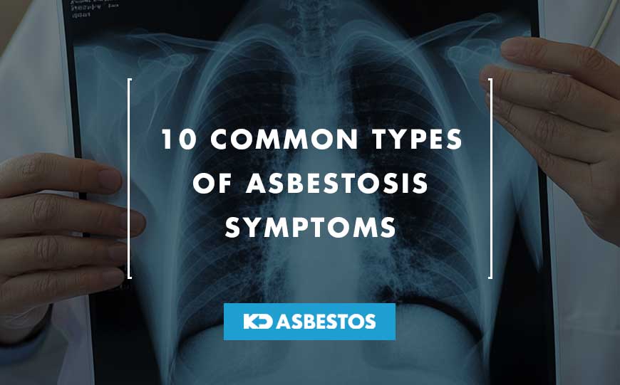 asbestosis symptoms